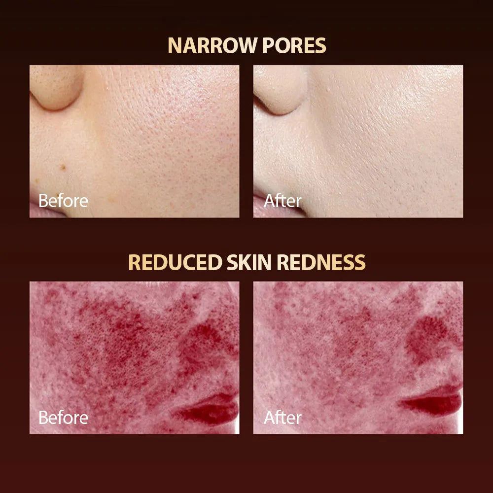 7-Hue LED Skincare Mask